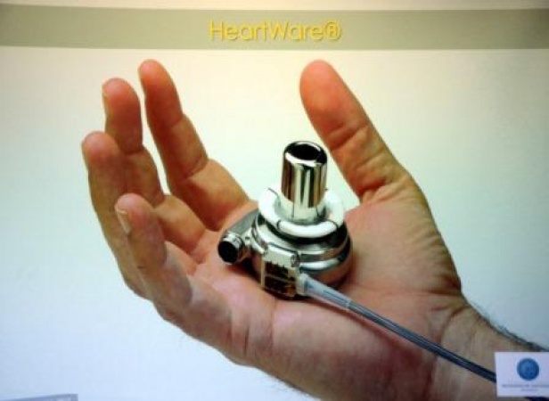 10 modernes LVAD